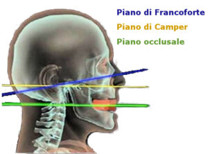 piano di Francoforte